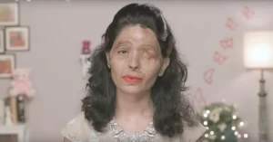 タイで頻繁に発生するアシッド・アタックという残忍な犯罪とは？