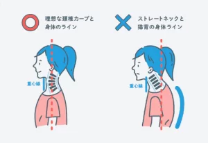 小さな子供でも注意が必要！「スマホ首」によるストレートネックのリスク