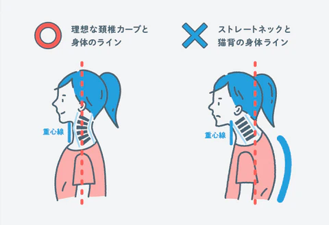 小さな子供でも注意が必要！「スマホ首」によるストレートネックのリスク